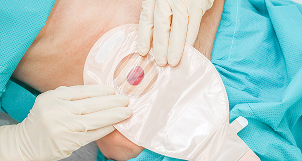 healthcare professional checking blood sugar level with a glucose monitor on a patient's finger emphasizing the importance of diabetes management and regular monitoring for optimal health seven days a week